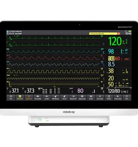BeneVision N17