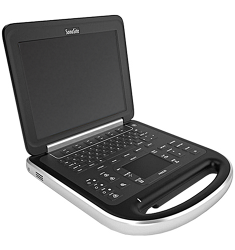 SonoSite Edge